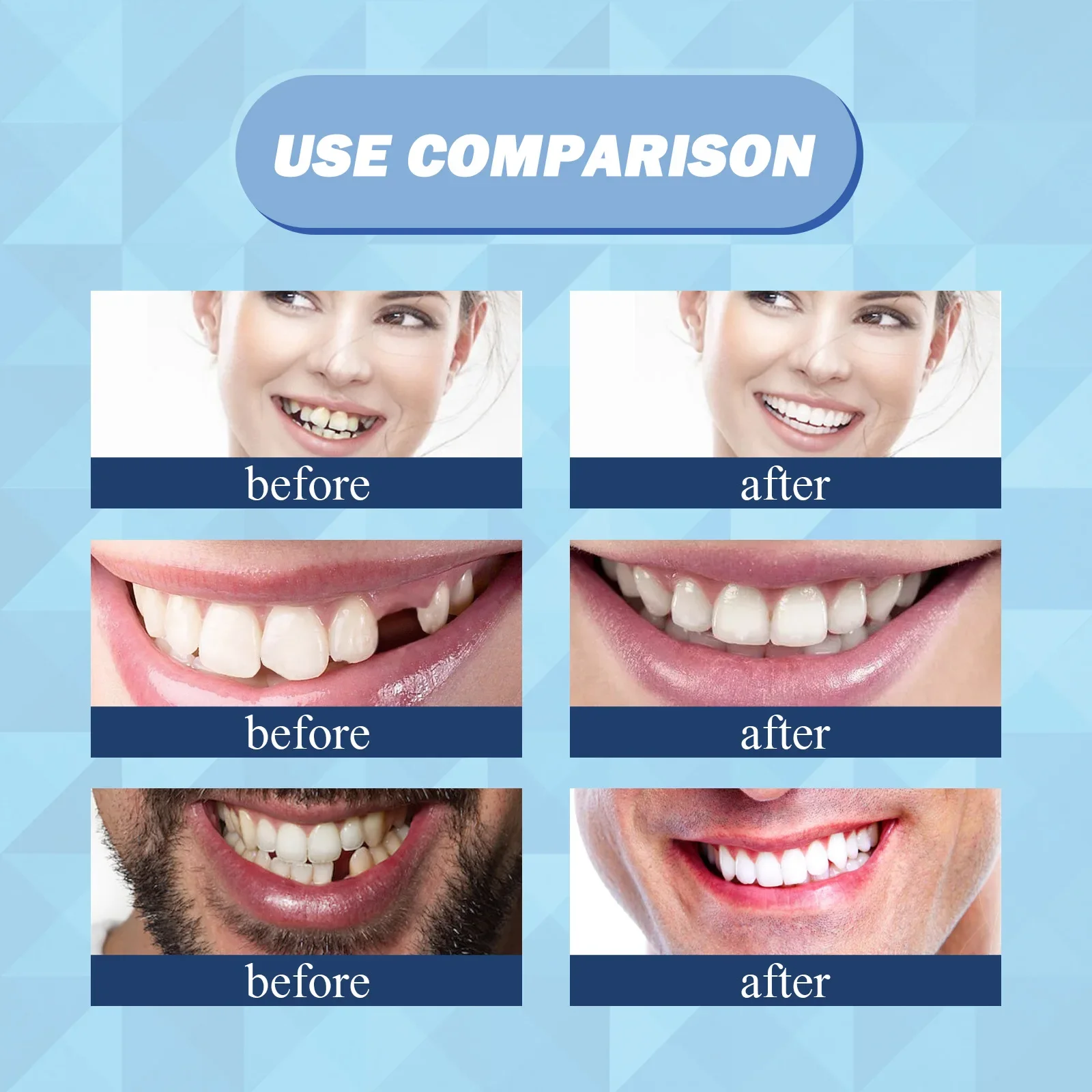 10 جرام/الحقيبة طقم تصليح الأسنان-خرز حراري لملء إصلاح الأسنان المفقودة والمكسورة أو لاصق طقم الأسنان وهمية جوتا لكل #6