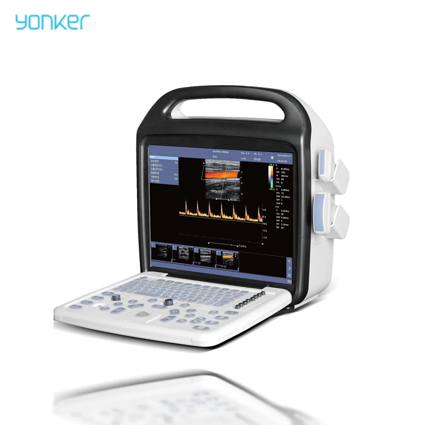 Yonker YK-UP8 Portable 64 Channels Ultrasound Machine Double Probe Interface Color Doppler Ultrasonic Ultrasound Machine