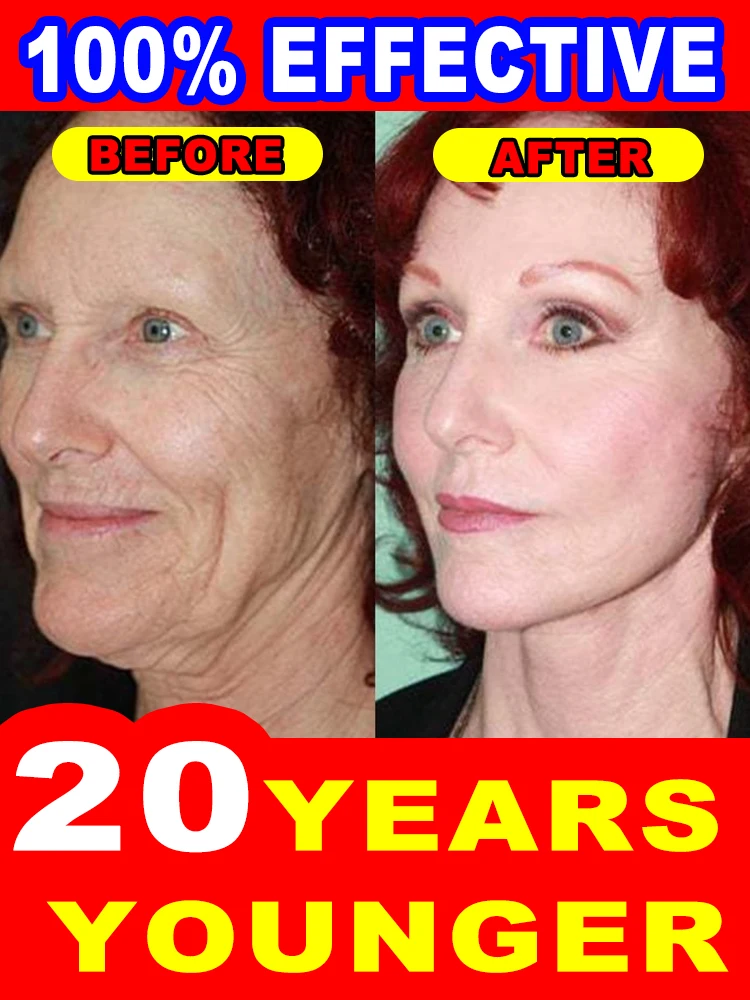 

20 years younger, no fine lines
