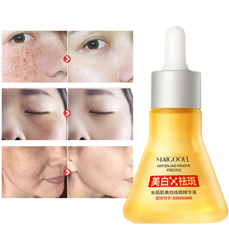 

Skin Whitening Freckle Serum Moisture Nourish Skin Refreshing Fade Black Spots Age Spots Brighten Skin Tone Correcting Serum