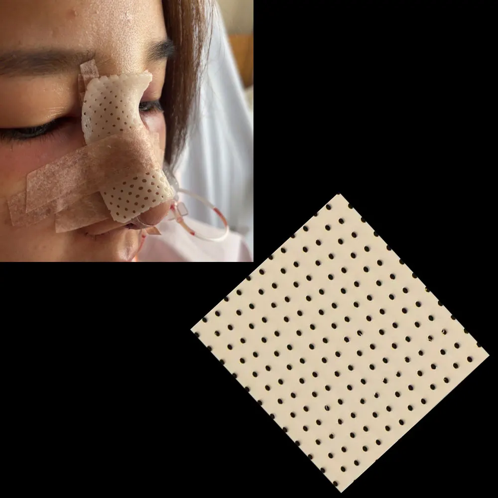 10pcs 5/7.5/10cm Thermoplastic Nasal Splint Rhinoplasty Immobilized Trapezoidal Nasal Splint Low Temperature Nose Splint Ortho