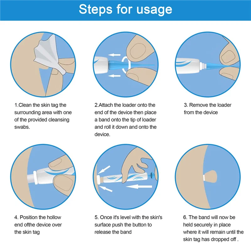 2X 스킨 태그 점 제거 키트 스킨 태그 제거 기기 성인용 점 제거 고무 링 포함 얼굴 관리 도구