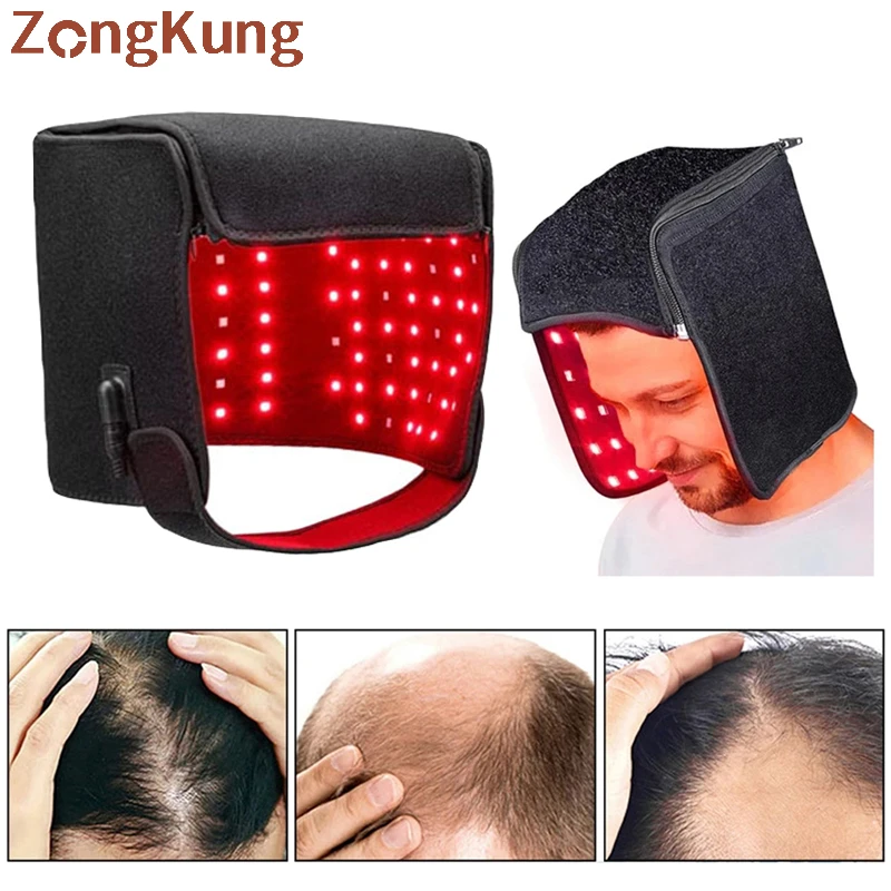 

215 Leds Red Light Therapy Hat Red Light Helmet For Hair Growth Repair Follicles And Scalp Anti Hair Loss Treatment