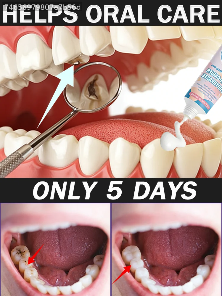 

Pʀᴇᴠᴇɴᴛs ᴄᴀᴠɪᴛɪᴇs, ʀᴇᴍᴏᴠᴇs sᴛᴀɪɴs, ғʀᴇsʜᴇɴs ʙʀᴇᴀᴛʜ, ᴘʀᴏᴍᴏᴛᴇs ᴏʀᴀʟ ʜʏɢɪᴇɴᴇ