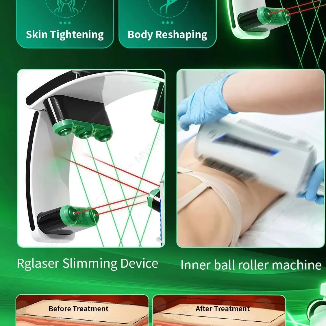 10D Low Level Green Light 10d 532nm Laser 360 Rotating Lymphatic Drainage Machine Body Massager Cellulite Cold Laser Therapy