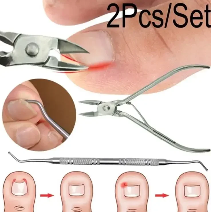 Ingrown Toenails Pedicure Foot Care Tool Nail Correction Clipper Cutters For Orthotic Acronyx Dead Skin Remover Podiatry