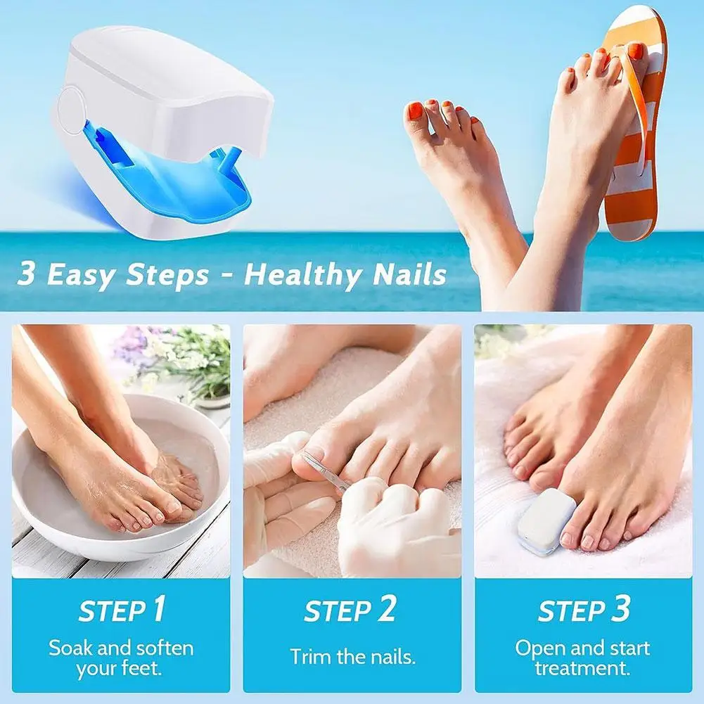 Unha fungo Laser tratamento dispositivo, Carregamento USB, Unhas, Unhas dos pés, Onychomycosis terapia cura máquina, Unisex Foot Care Tools