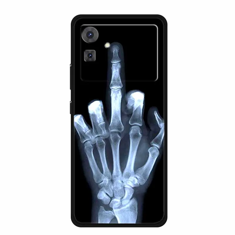 For Cubot Note 21 Case 6.56\