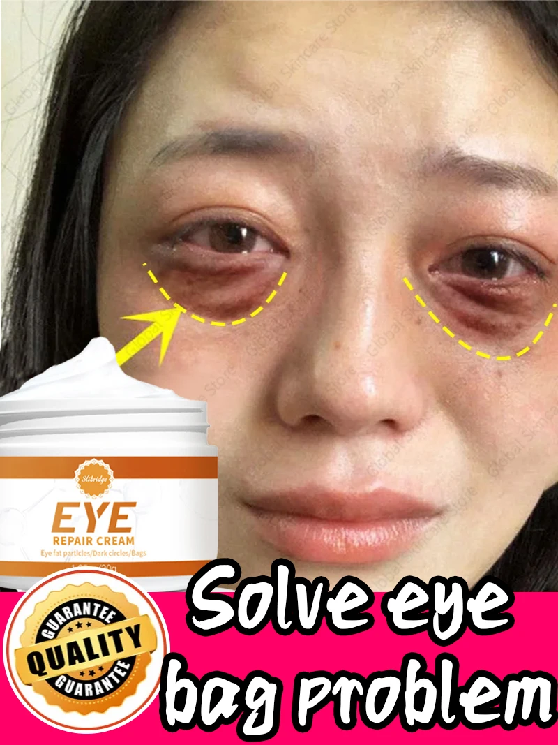 Eye Care For Creams