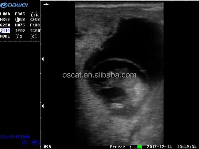 OSCAT Veterinary Ultrasound Pregnancy Ultrasound Scanner For Animal Dog Vet Portable Digital Ultrasound