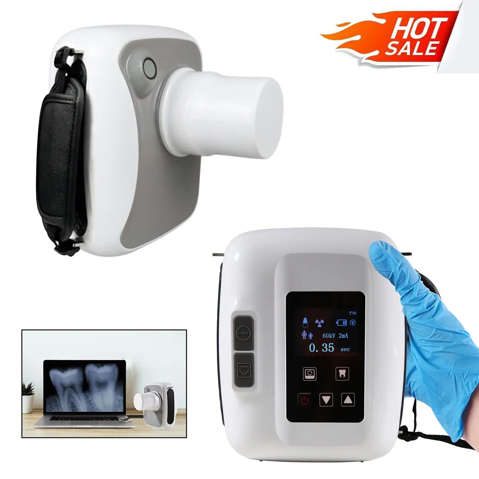 

Portable Dental Digital X-ray Machine High Frequency Xray Unit System Handheld