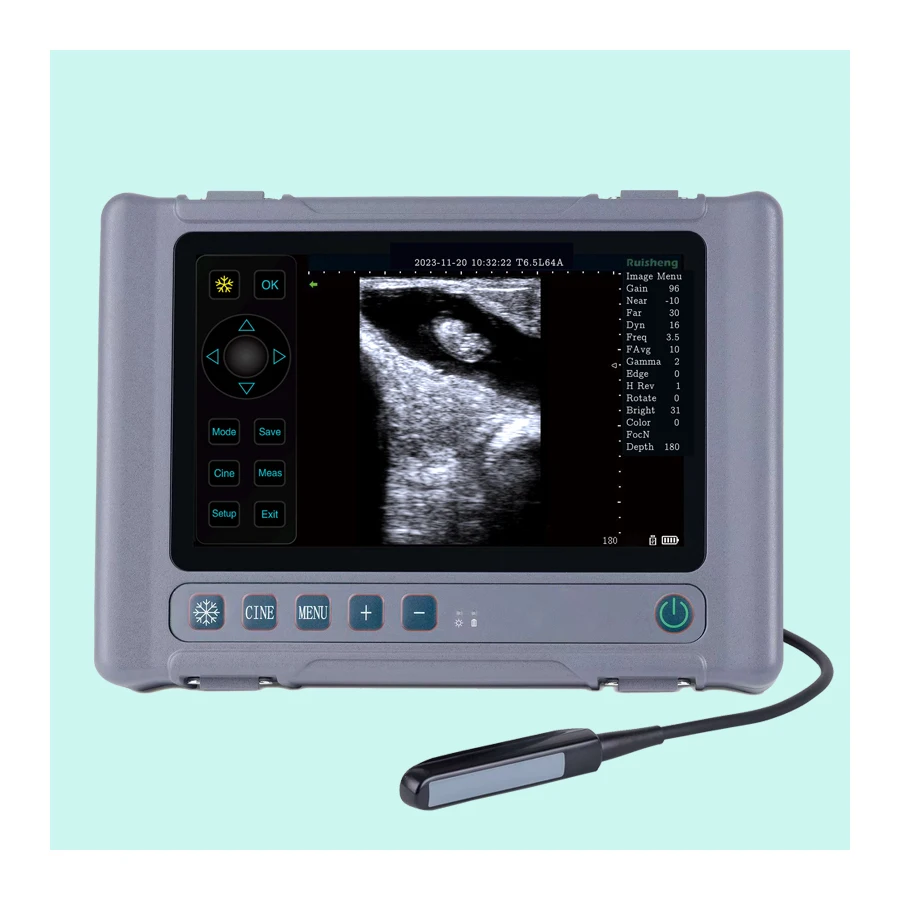 

Top Animal Device Ultrasound Machine Veterinary Vet Ultrasound Scanner for Pregnancy Cattle, Horse Use