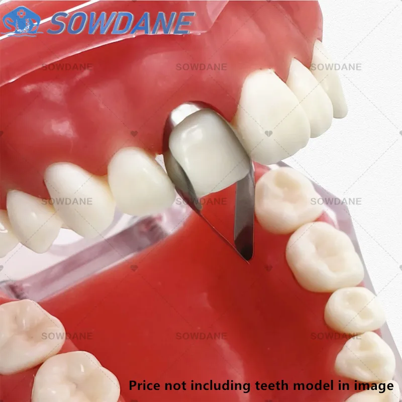 شرائط أمامية قريبة كبيرة للأسنان أنظمة مصفوفة مصفوفات أمامية مزدوجة مواد ترميم الأسنان