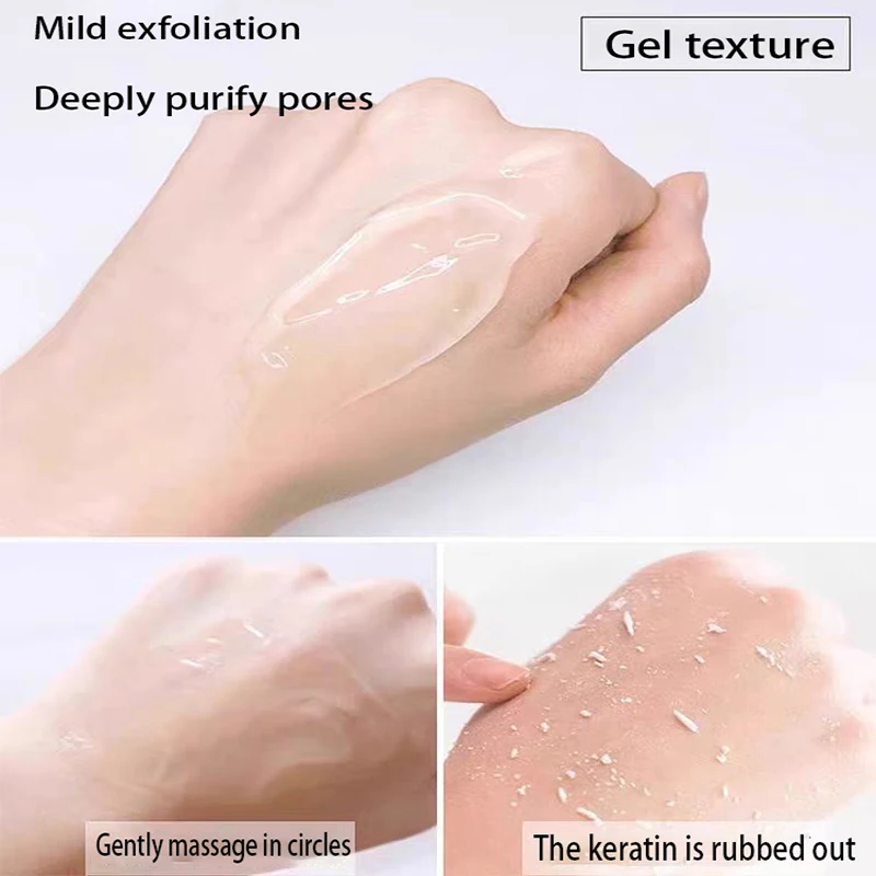 Exfoliating Facial Cleanser Fruit Acid Foam Cleansing Moisture Anti Acne Control Oil Nicotinamide Facial Gel Korean Cosmetics