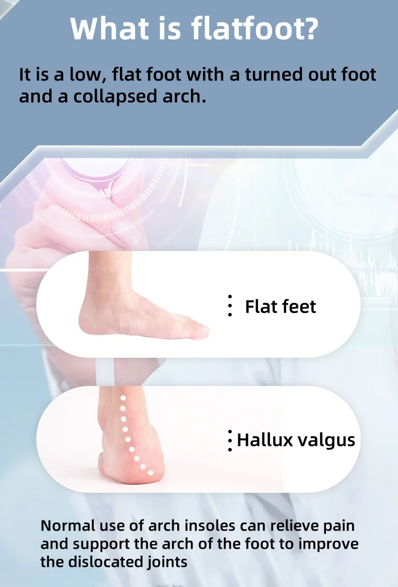 1 Pair Arch Support Plantar Fasciitis Insoles Soft Sole Shock-Absorbing Sports Shoes Insoles Flat Foot Orthopedic Insoles Unisex