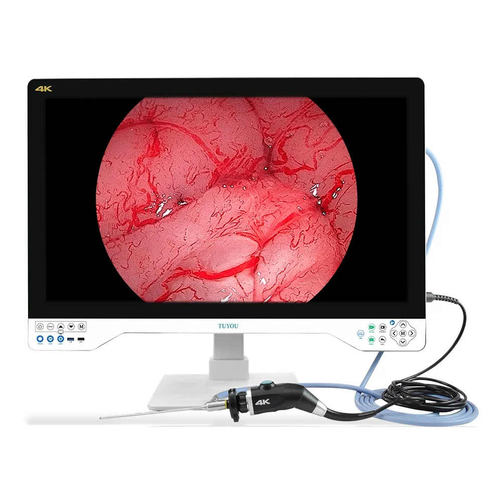 Tuyou 32''  Portable Rigid Medical Video Endoscopy Camera System come with LED Light Source for Laparoscopy  Urology