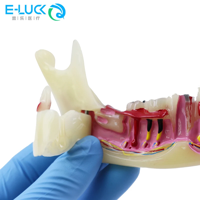 

Модель зубных зубов Модель эндодонтического лечения Анатомия десен Анатомическая модель ткани нижней части Стоматолог Обучение демонстрации