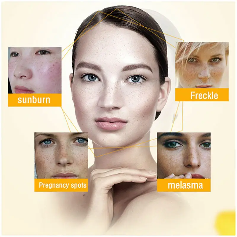 Dimollaure Whitening Freckle Cream Anti-wrinkle Removal Melasma Freckle Age Spot Pigment Melanin Brighten Face Skin Care