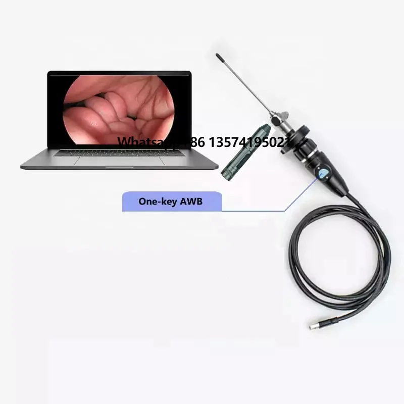 

Portable Endoscope System with FHD 1080P Resolution Works for ENT Endoscopy
