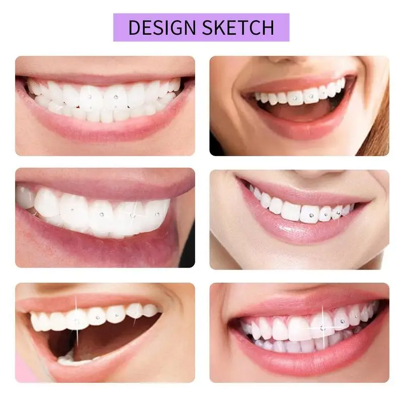 DIY Tooth Decoração Gem Kit para Mulheres, Confiável, Portátil, Completo, Bonito Aplicação, Diamante Forte, Dentes Gem Set