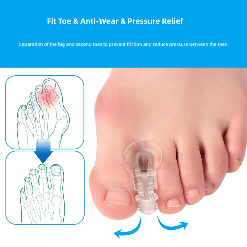 Sophia-Mathiateur de gros pieds, 2 pièces = 1 paire, coussretours d'Li-en silicone pour hallux valgus