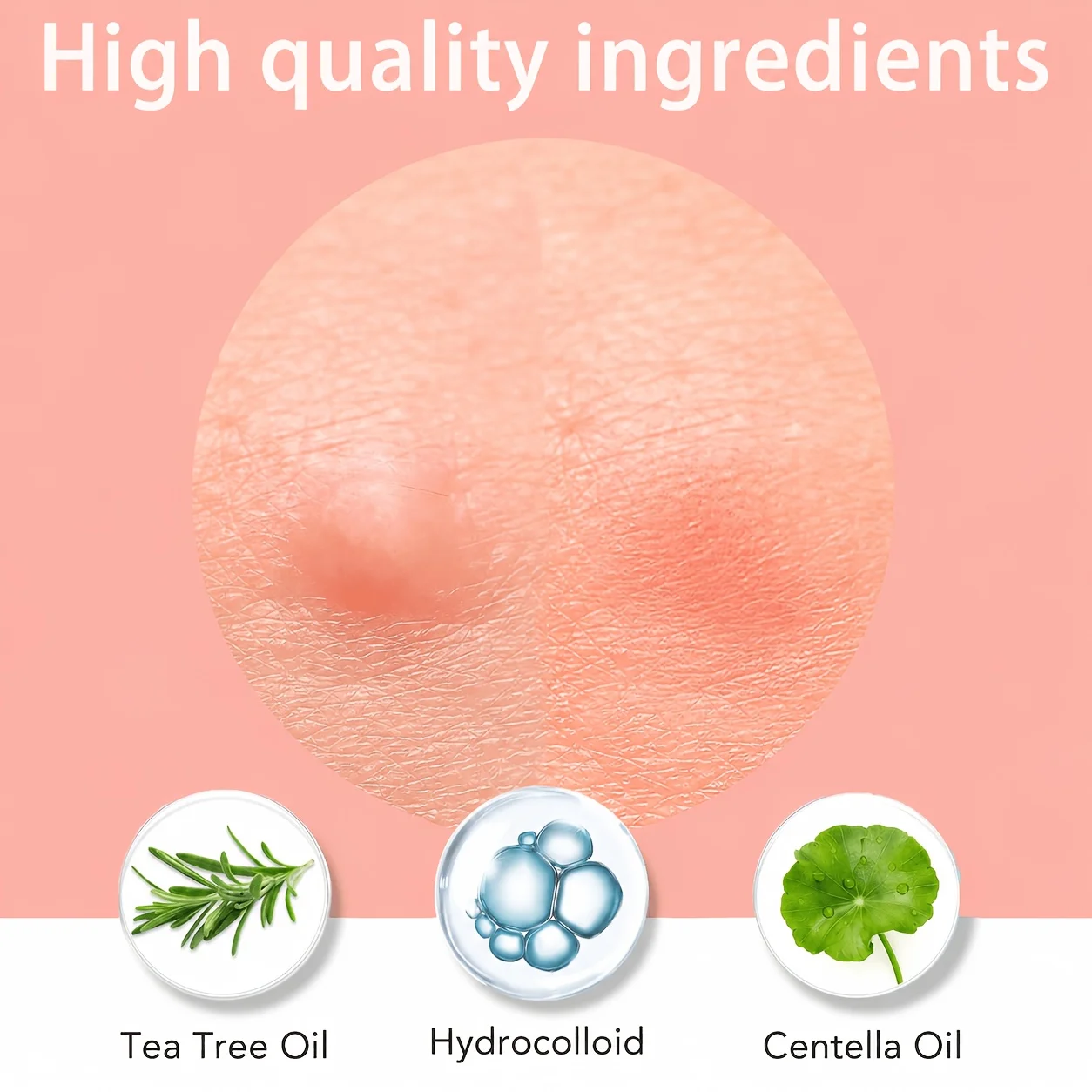 1200/400pcs/box invisible acne patch set - deep cleaning high-quality water-based acne stickers, gentle and skin friendly - view 2