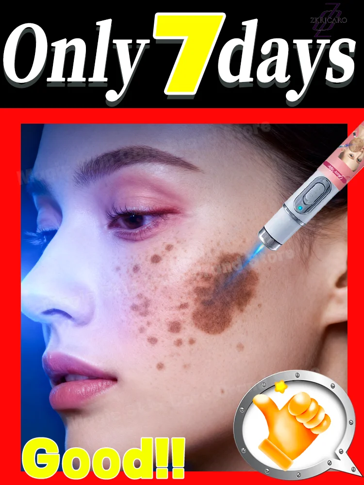 이온 블루라이트 케어 도구 기술로 반점을 비추어 제거, 고품질 정밀 기기, 100% 모든 색소 침착 제거.