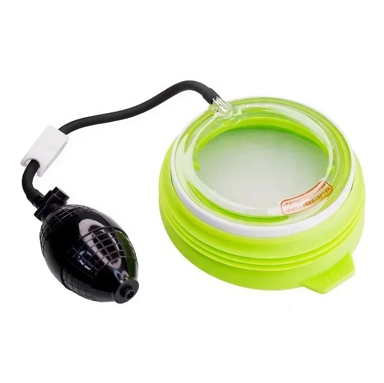 

Vacuum Bells of Pectus Excavatum/Sunken Chest Is Effective