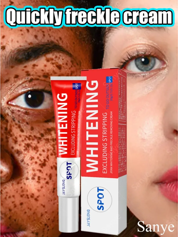 Buy 1 Get 3 Whitening Freckles Cream Dark Spots Removal Cream Fade Spots Melasma Brightening Lotion Anti-acne Moisturize Skin