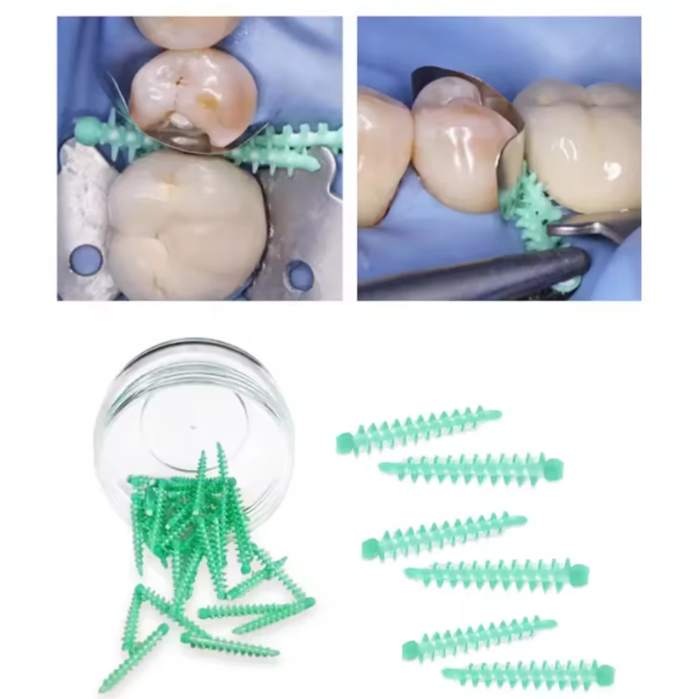 

40pcs Dental Adaptive Silicone Interdental Wedges Autoclavable Matrix for Composite Restorations Medical Grade Dentist Materials