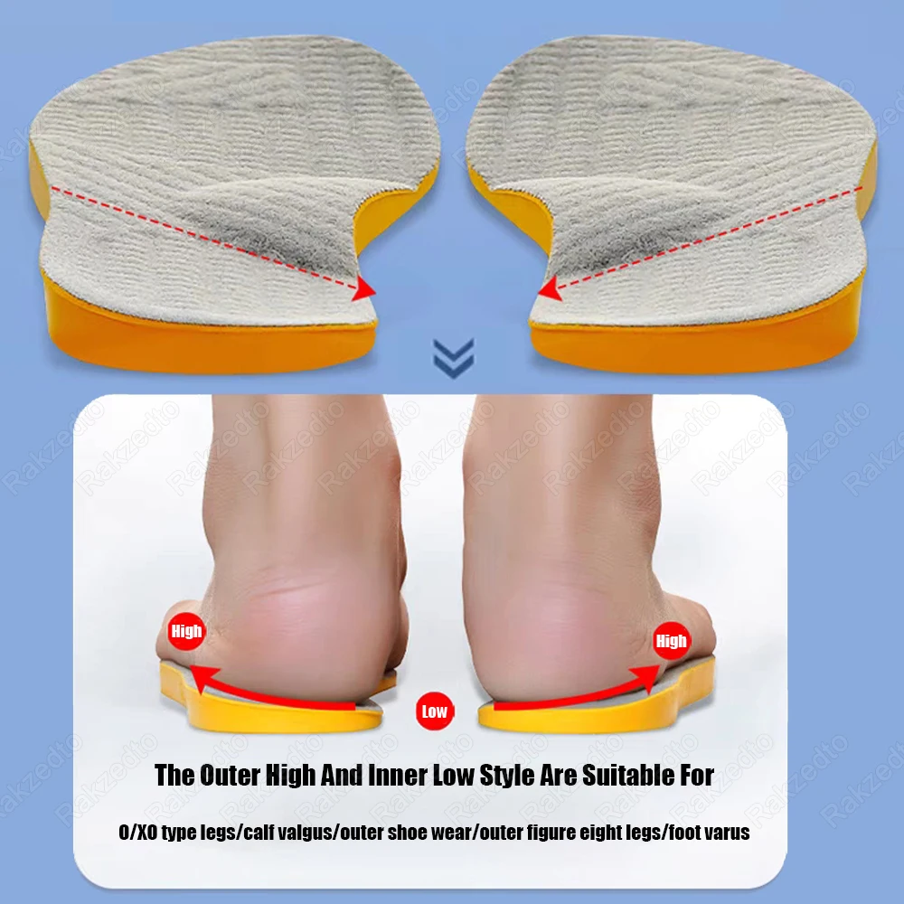 Arch Support Flat Feet Corrector Insoles for Shoes Men Women Children O Type Legs Valgus Orthopedic Foot Insoles Sport Shoe Pads