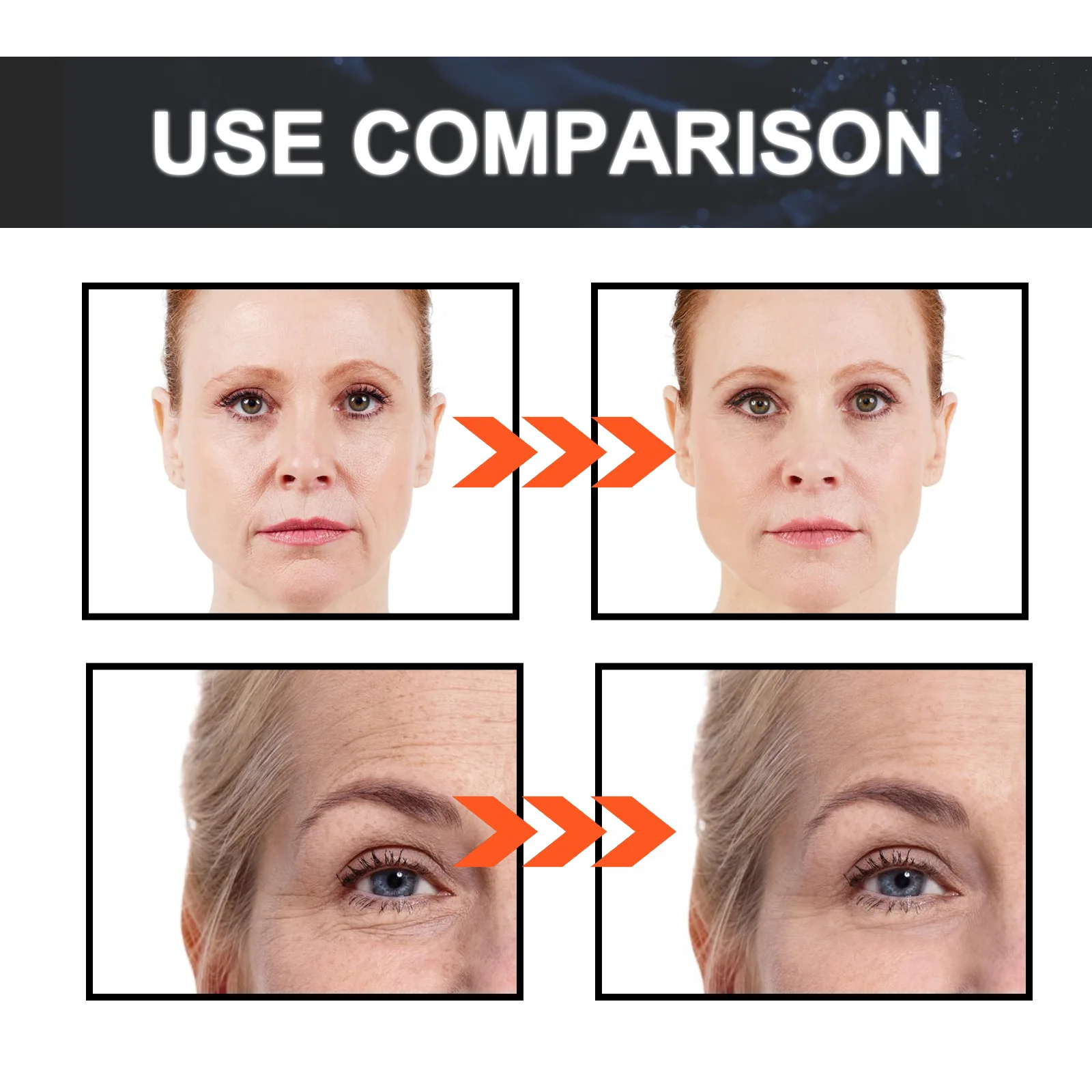 O soro facial ordinário antienvelhecimento de Retinol, remove o enrugamento, levantamento, ilumina a pele, desvanecem-se linhas finas, hidrata, pele