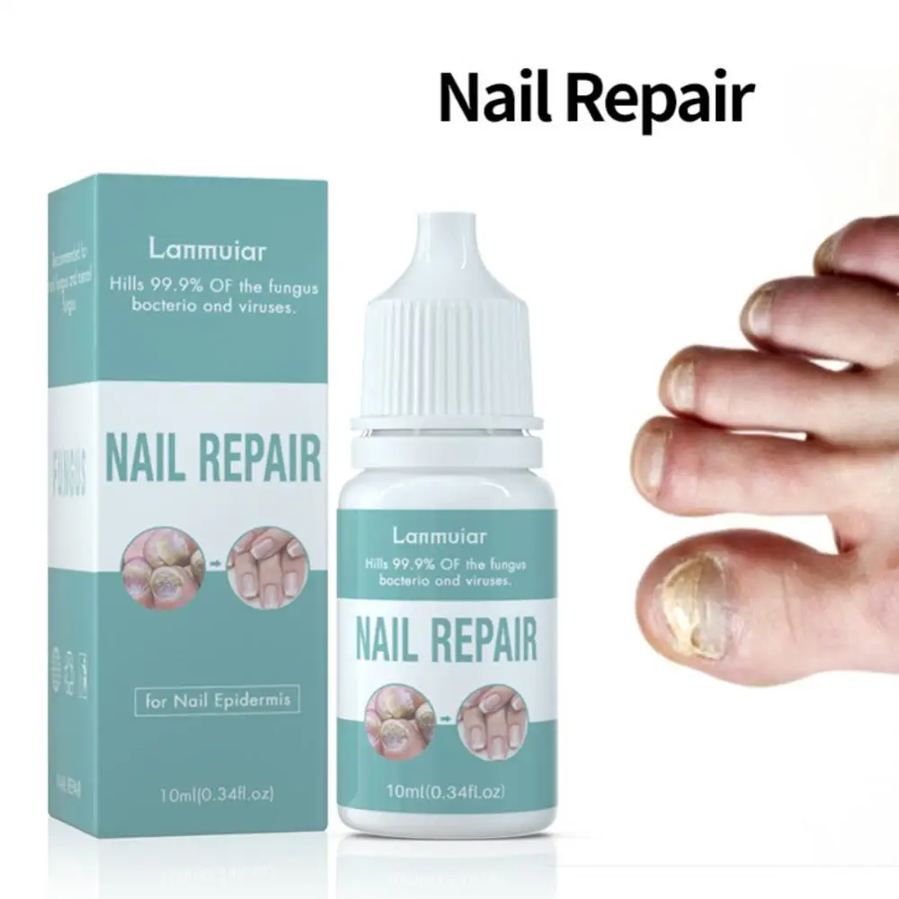 15ml Pilz Nagel Reparatur Serum Fuß Zehen Nagel Pilz Atreatment Nägel Gel Anti Paronychie Onycho mykose Nägel Pflege tslm2