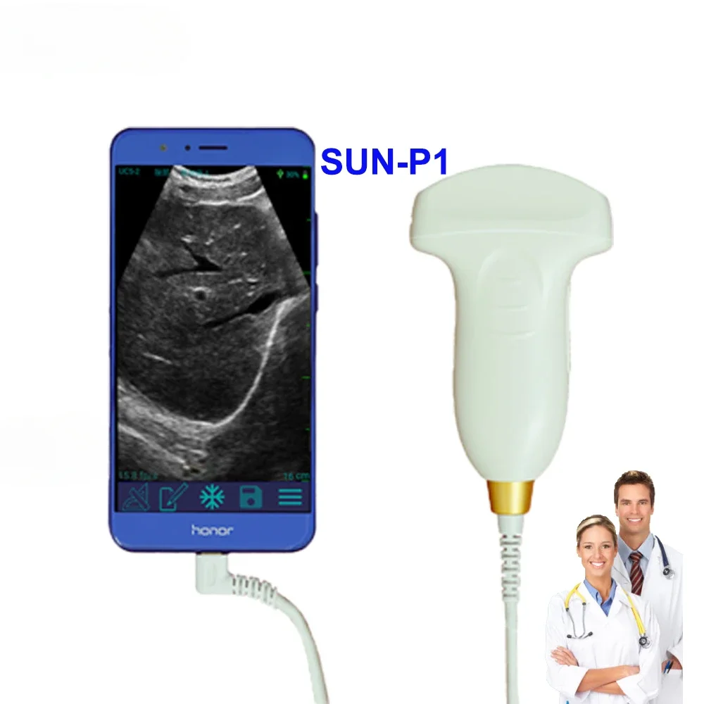 2.5-10Mhz wireless USB probe Mini ultrasound device