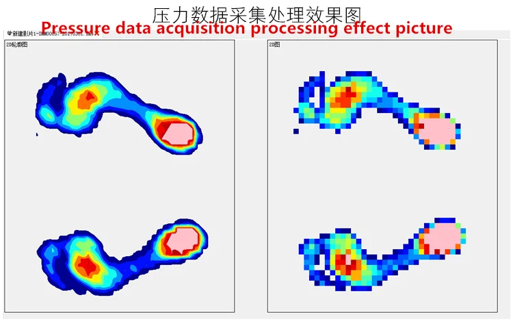 

Pressure distribution detection sensor array vola/planta pedis cushion system for fsr Pressure Sensor
