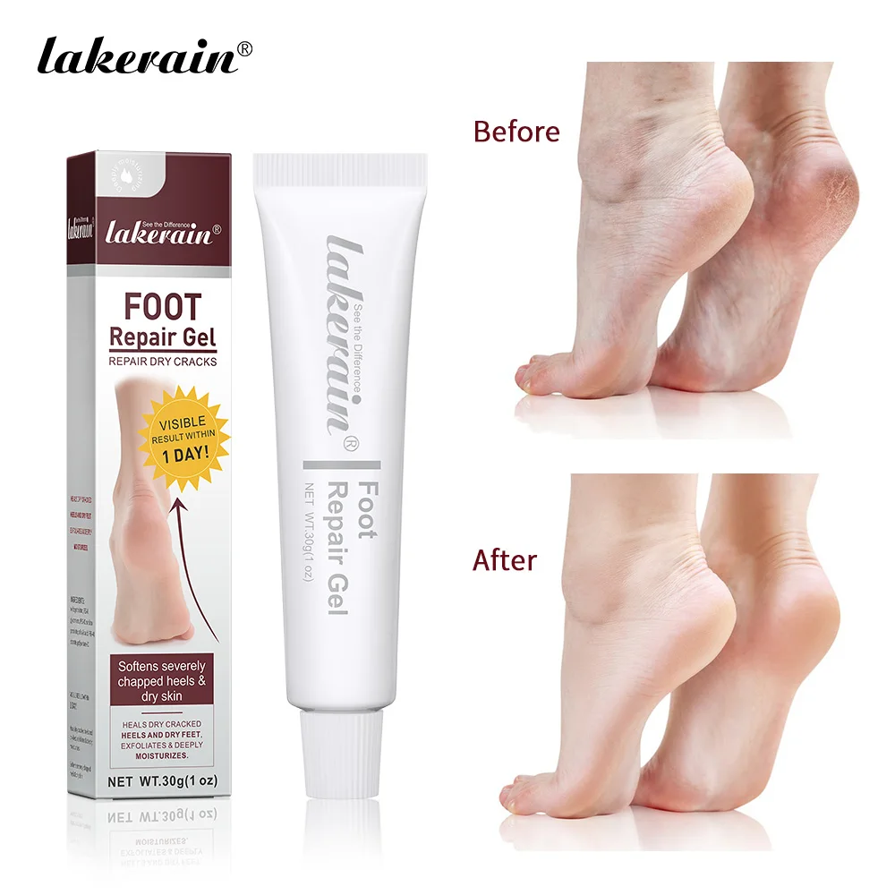 30g Intensive Foot Repair Anti Crack Heel Repair Cream for Cracked Heels and Dry Feet Foot Cream Removal Dead Skin Foot Mask