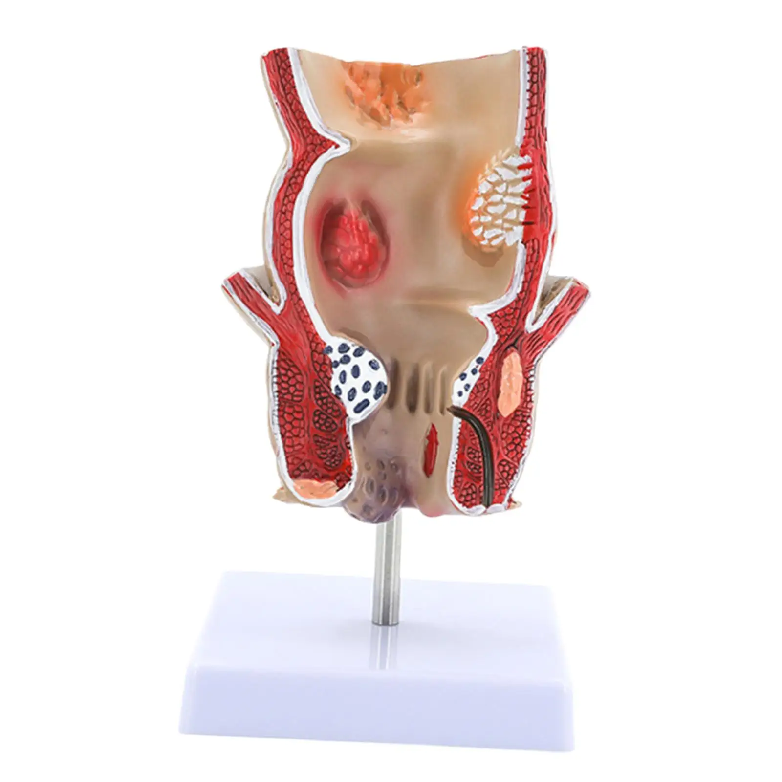 نموذج علم أمراض البواسير المستقيم البشري أداة تعليمية لمدرسة الفصل الدراسي