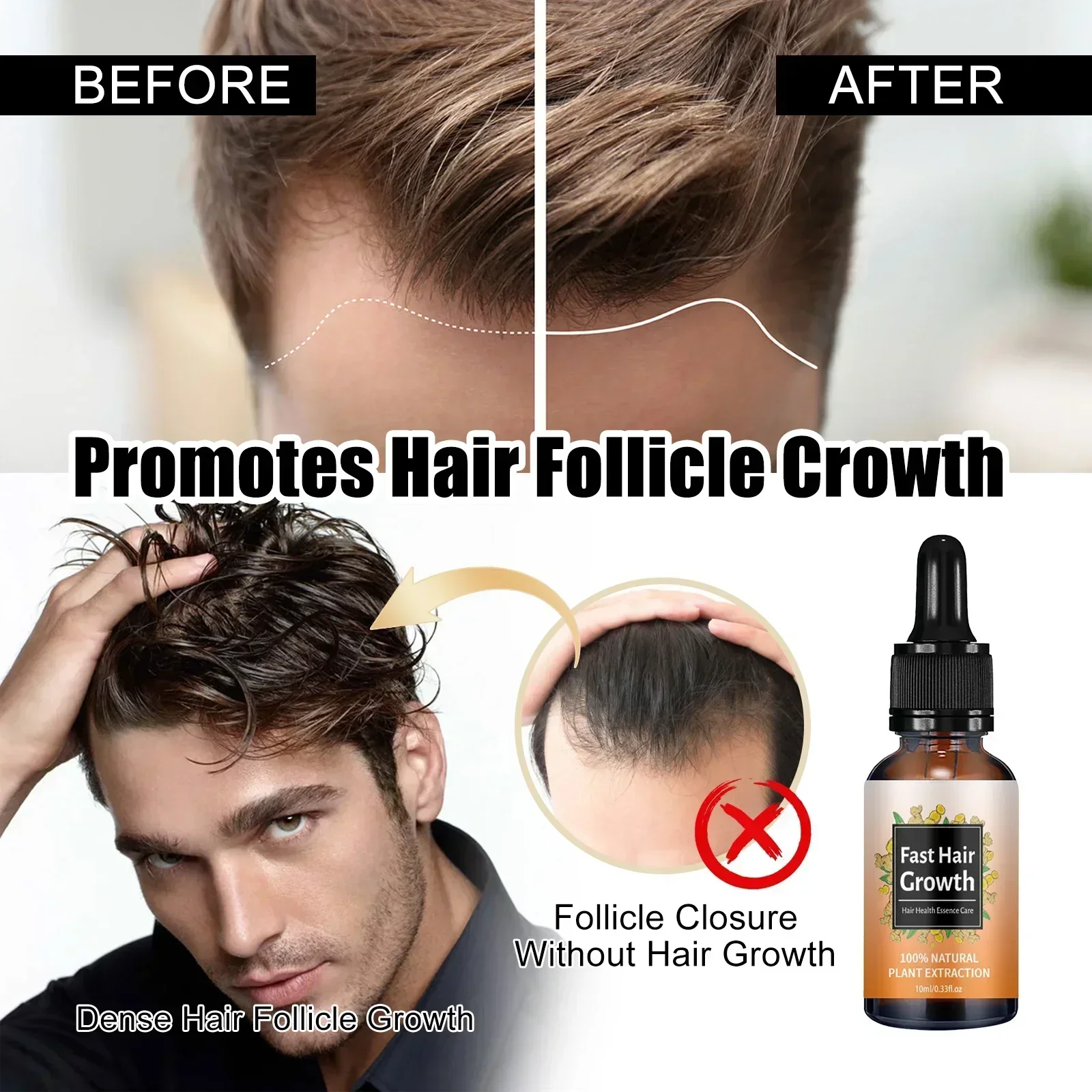 Hair Growth Essential Loss Regrowth Treatment Strengthens Hair Nourishes Scalp Light Weight Non Greasy Improve Scalp Circulation