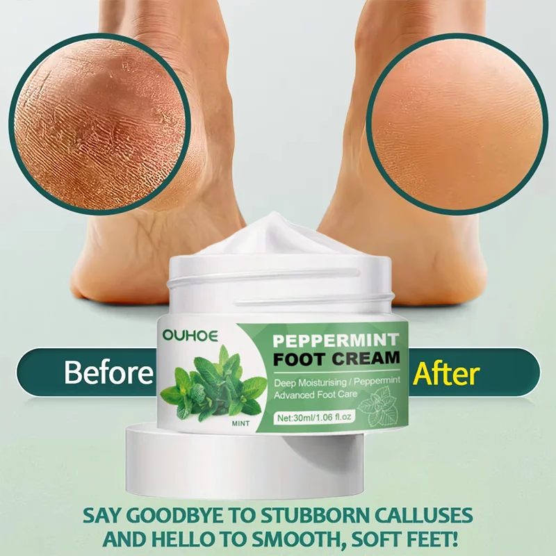 Crema para pies PepperMint, producto para eliminar la piel muerta, tratamiento de reparación de grietas en el talón, hidratante, cuidado de la piel de los pies y las manos, bálsamo para eliminar la piel muerta
