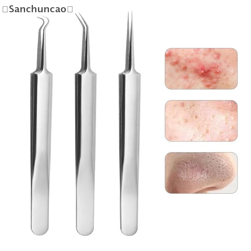 soiSan Parque5/7/8 stuks Ultrafijne celpuistjes Mee-eter Clip Pincet Schoonheid Gezicht Gezondheid Salon Speciale mee-eter verwijderaar Acne Naald