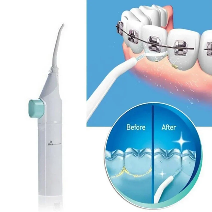 40ML Vệ Sinh Răng Miệng Răng Irrigator Di Động Nha Sĩ Nha Khoa Răng Miệng Irrigator Chỉ Nước Flosser Răng Bụi Bàn Chải Đánh Răng Irrigator