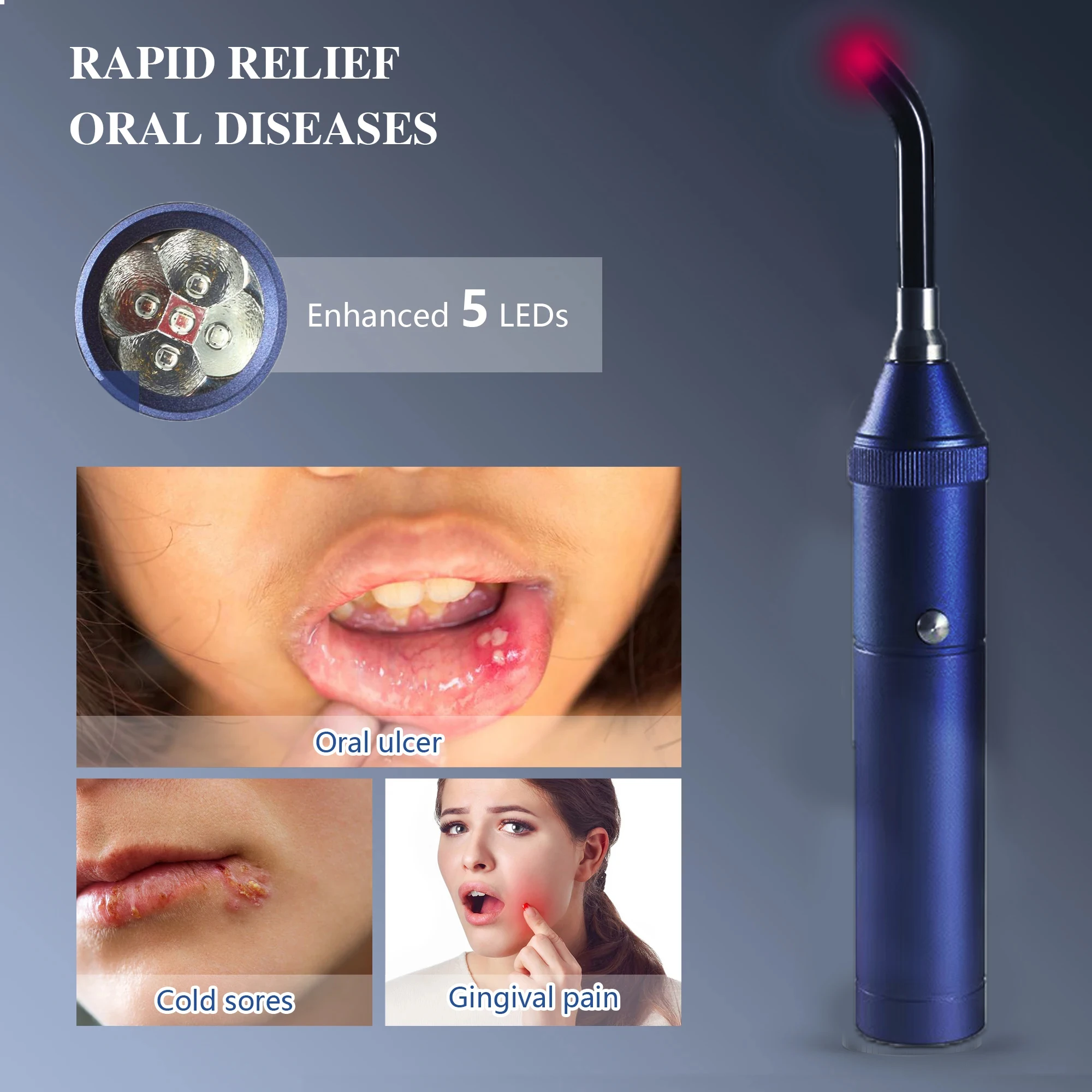 

Cold Sore Laser Therapy Device for Canker Sore Lip Herpes Oral Ulcers Nasal Soreness 3 in 1 Body Pain Relief Device