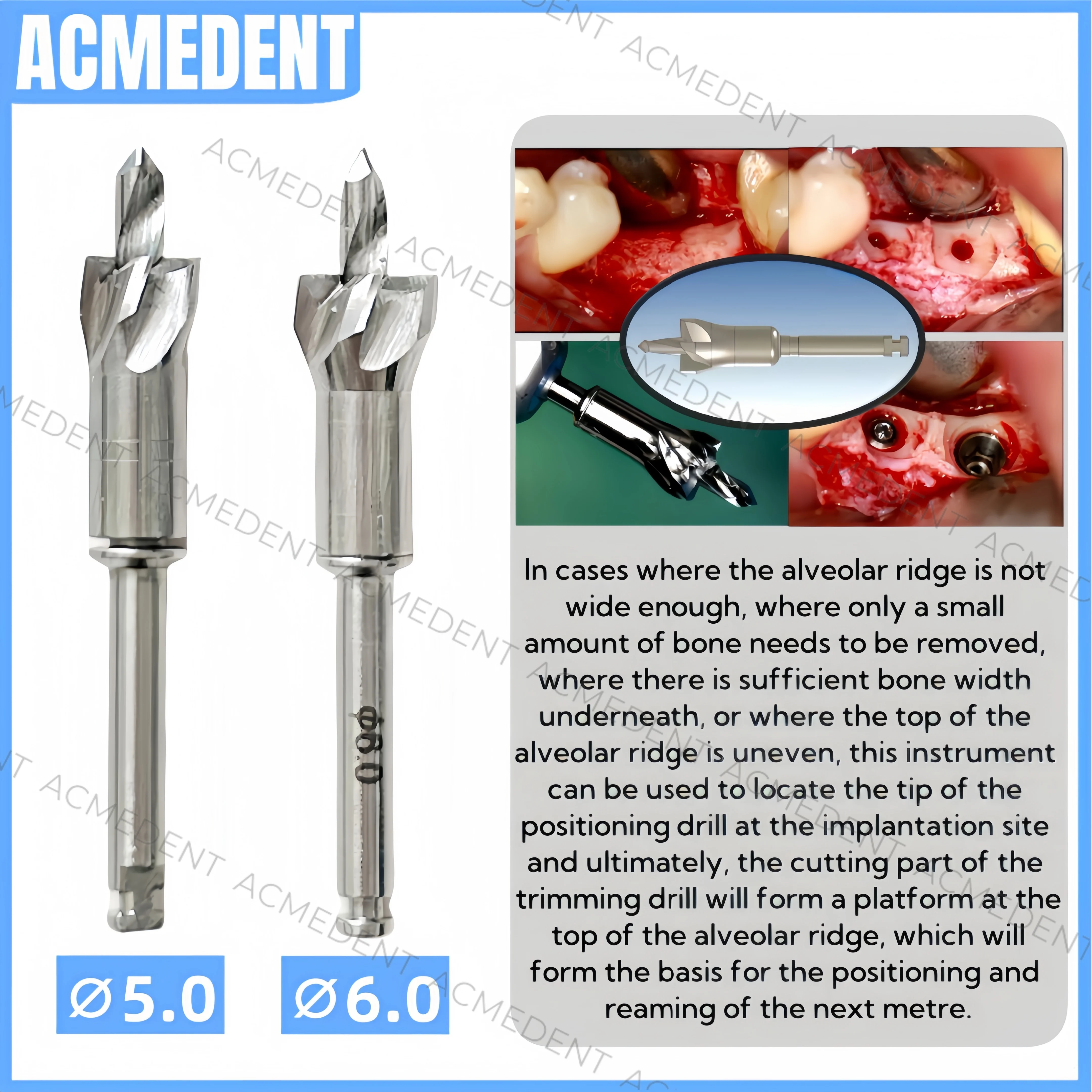 Bone Mill Kit Dental Implant Bone Profiler Bladed Alveolar Ridge Trimmer Drill with Pilot Grinding Bur Surgical Instrument