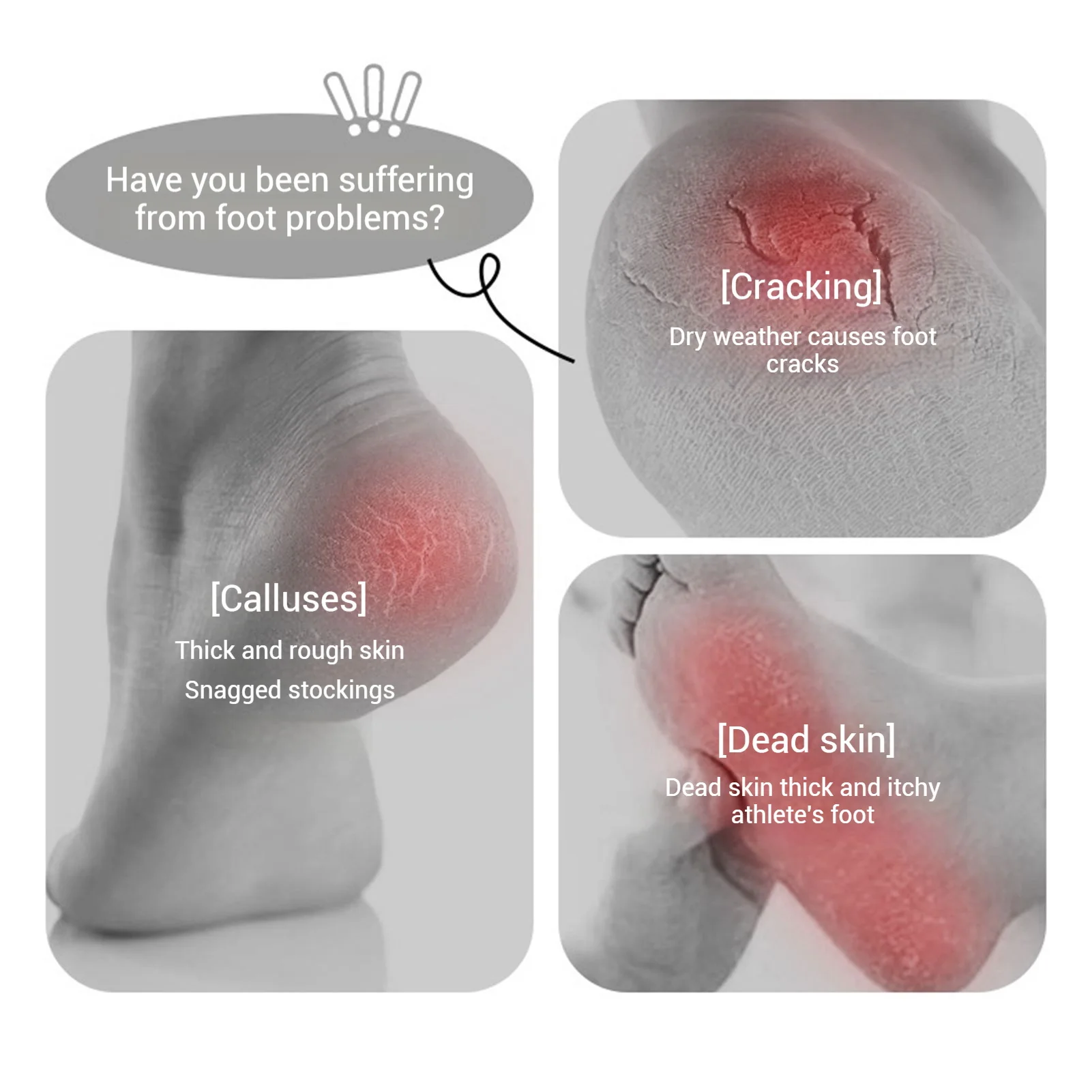 أداة باديكير مزيل مسامير القدم مزدوجة الجوانب مع مقبض مضاد للانزلاق للاستخدام الجاف والرطب والعناية بالقدم أثناء السفر باللون الأصفر والأبيض