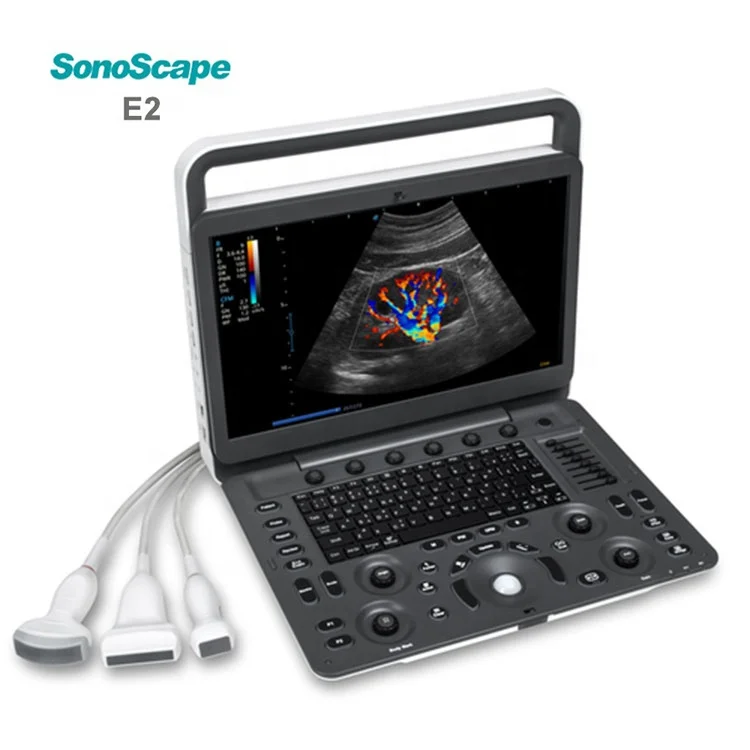 2023 Medical Ultrasound Instrument MSK OB/GYN 3D 4D 5D Ultrasound Scanner Sonoscape E2 Portable Ultrasound Machine