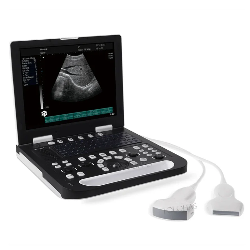 

LHAN50 Small ultrasound machine full digital ultrasonic diagnostic instruments laptop ultrasound system price