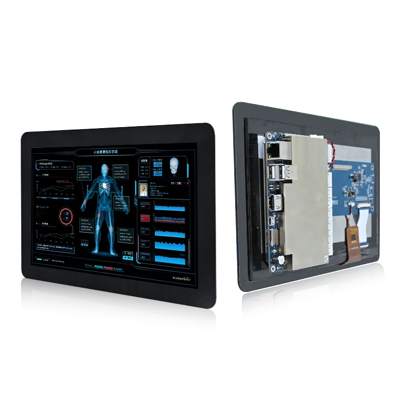 Forlinx FDUT507-C02 HMI Computer application in the medical