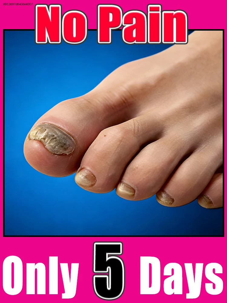 

2026 NEW Cleaning Nail Brush Tools Nail Art Manicureed Tool 2026 Hot Sale Foot Care Tools