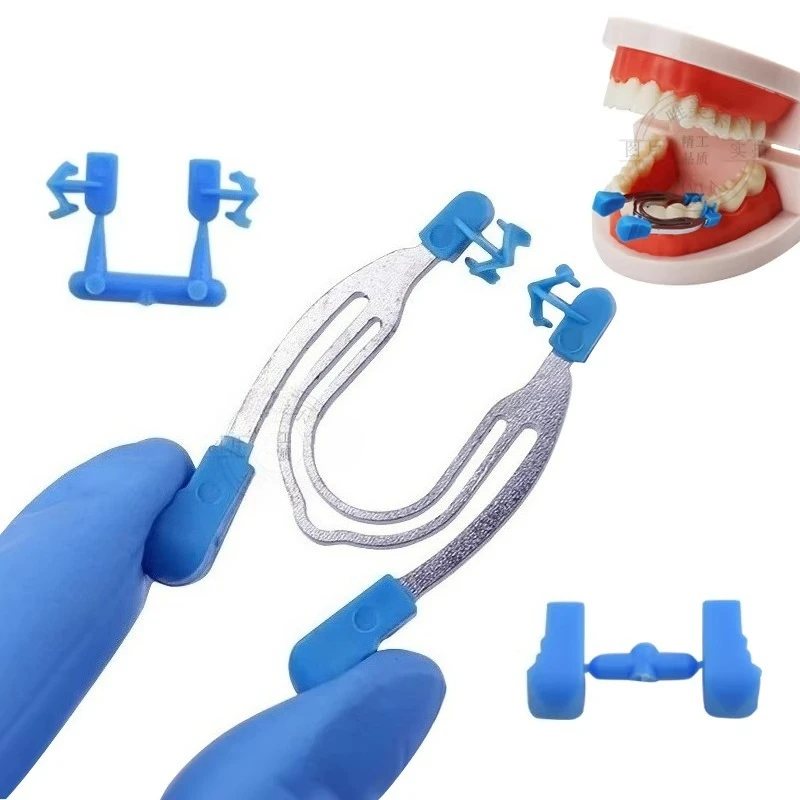 Lab Matrix Sectional Contoured Metal Spring Clip Rings Clamps Wedges Forming Sheet Clips Lab Tools