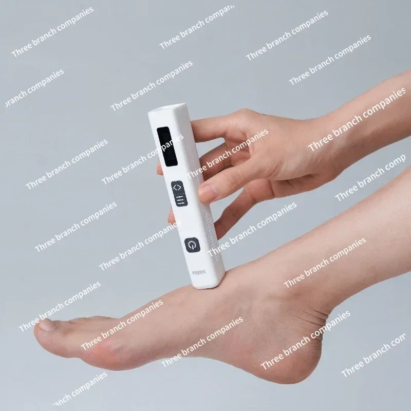 Excimer Laser 308nm Psoriasis Vitiligo Laser Machine for Vitiligo Treatment